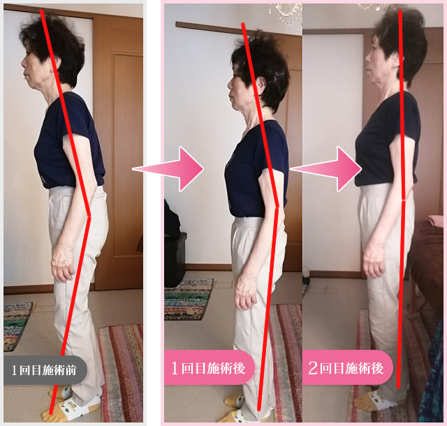 施術効果1