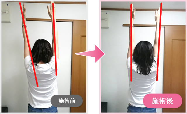 施術効果3
